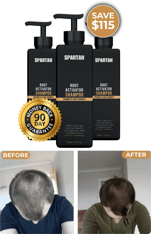 What is Spartan Root Activator Shampoo