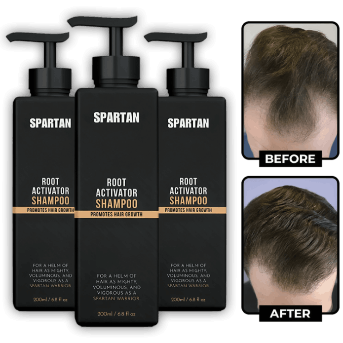 Spartan Root Activator Shampoo